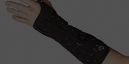 Man's arm wearing a cast